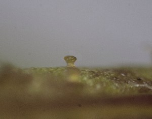 A glandular hair on the stem (microscope view)
