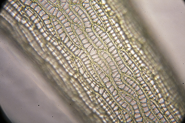 Sphagnum cells 600