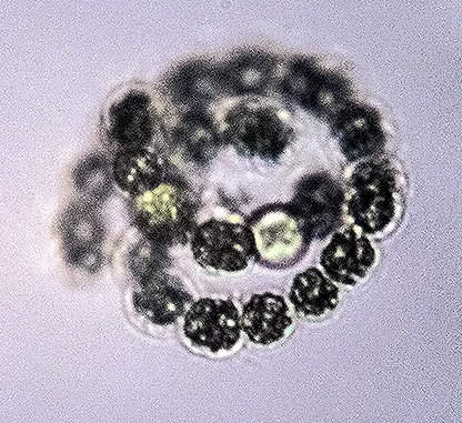 Anabaena circinalis 3