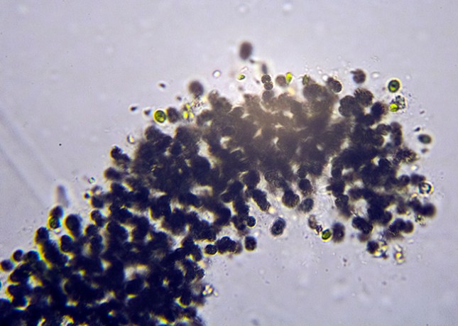 Microcystis