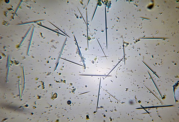raphides-1
