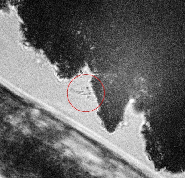 Gallionella 2 circled