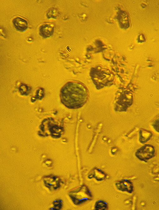 Trentepohlia from Cryptothecia
