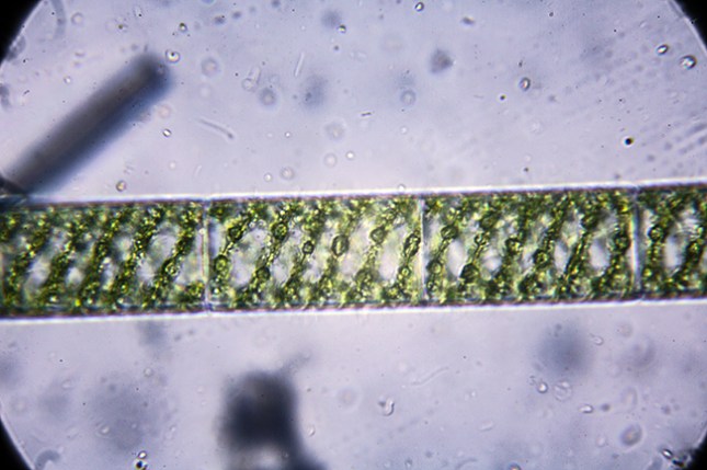 Spirogyra chloroplasts.jpg