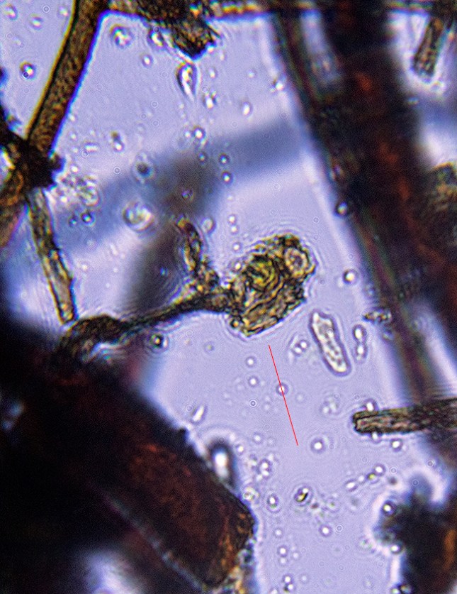 BRACHTMENIUM MACROCARPUM TUBER