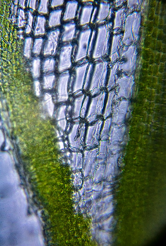 Syrrhopodon hyaline cells
