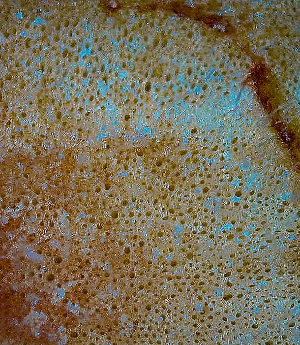 Rhizembryoslice neartop