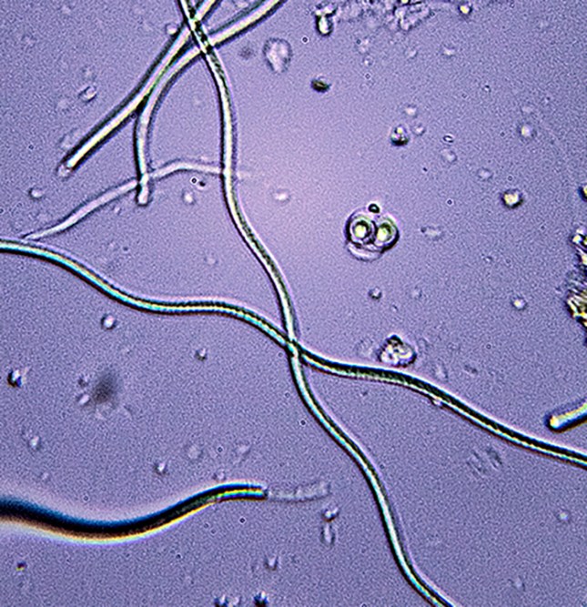 utricularia cysnobacteria3crop